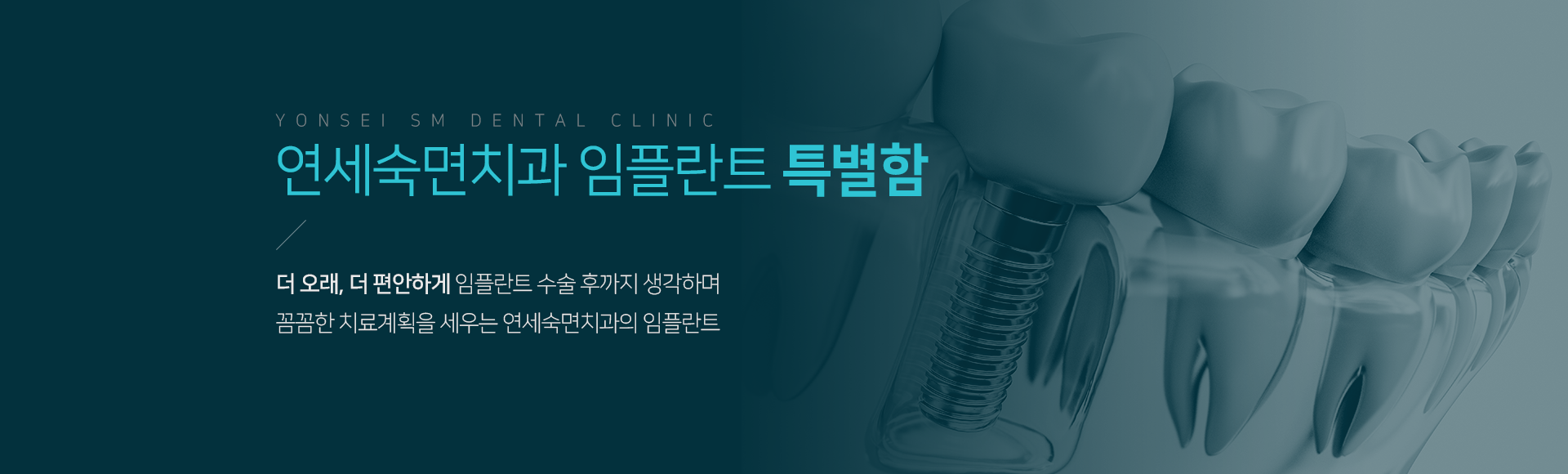 연세숙면치과-임플란트-특별함-더-오래-더-편안하게-임플란트-수술-후까지-생각하며-꼼꼼한-치료-계획을-세우는-임플란트