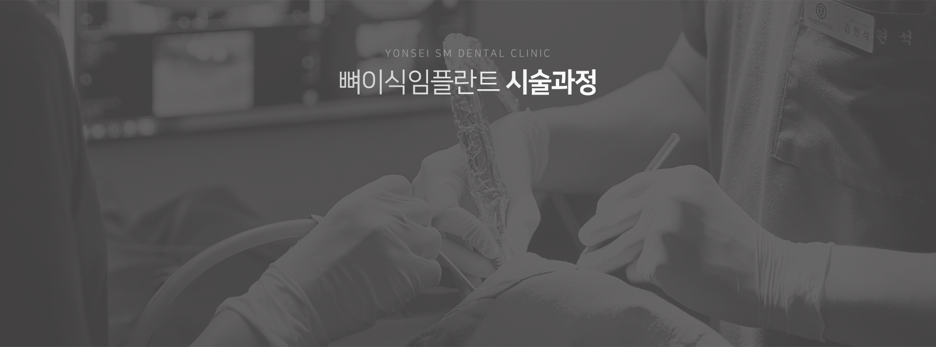 뼈이식-임플란트-시술-과정