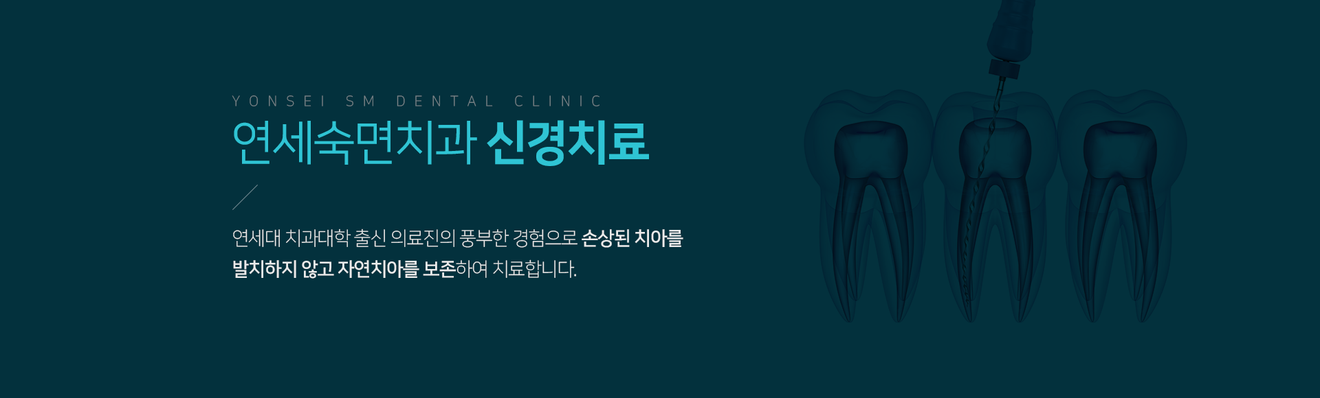 연세숙면치과-신경치료-연세대-치과대학-출신-의료진의-풍부한-경험으로-손상된-치아를-발치하지-않고-최대한-자연치아를-보존하여-치료합니다