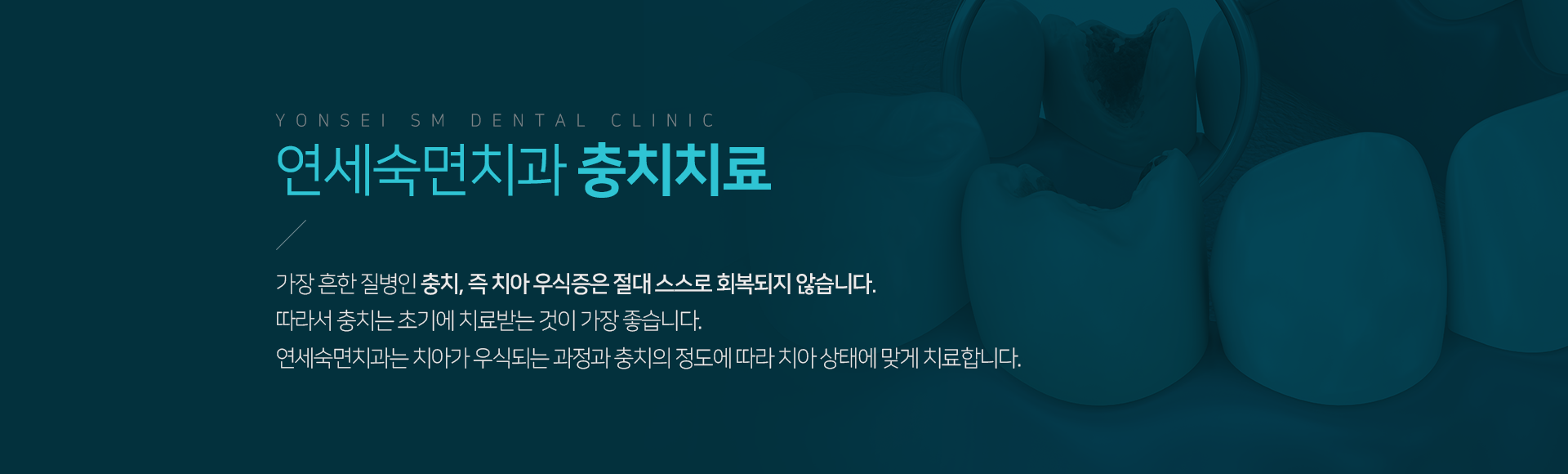 연세숙면치과-충치치료-가장-흔한-질병인-충치-즉-치아우식증은-절대-스스로-회복되지-않습니다-따라서-충치는-초기에-치료받는-것이-가장-좋습니다-연세숙면치과는-치아가-우식-되는-과정과-충치의-정도에-따라-치아-상태에-맞게-치료합니다