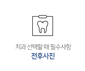 전후사진